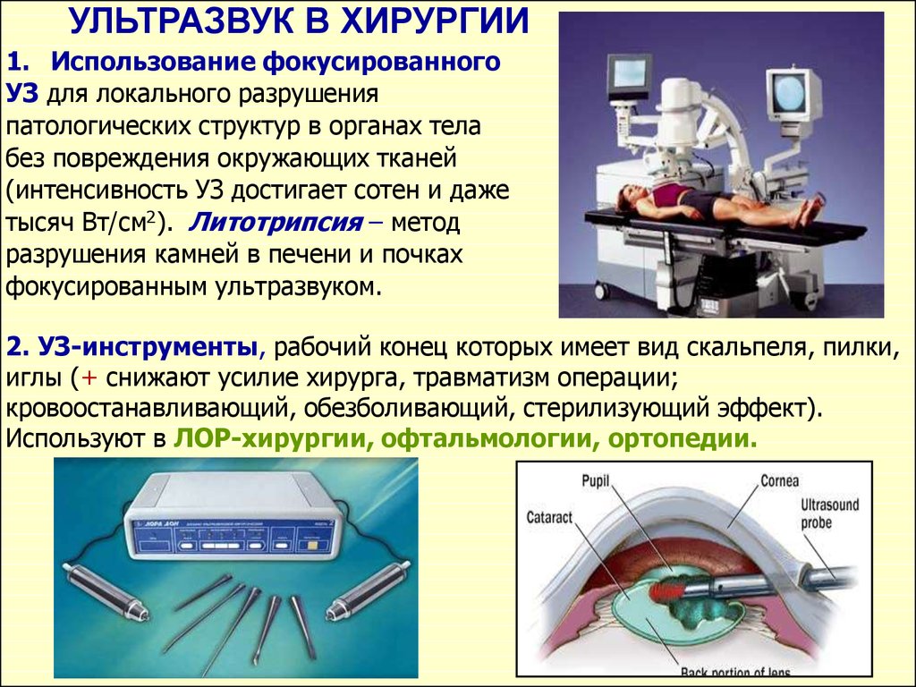 Где применяются ультразвуковые