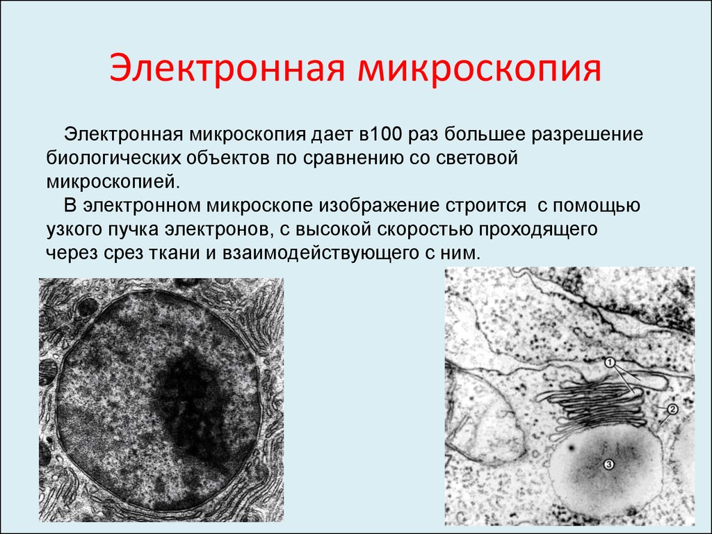 Микроскопия это. Строение клетки электронная микроскопия. Электронная микроскопия суть метода. Электронная микроскопия кратко. Электронная микроскопия разрешение.