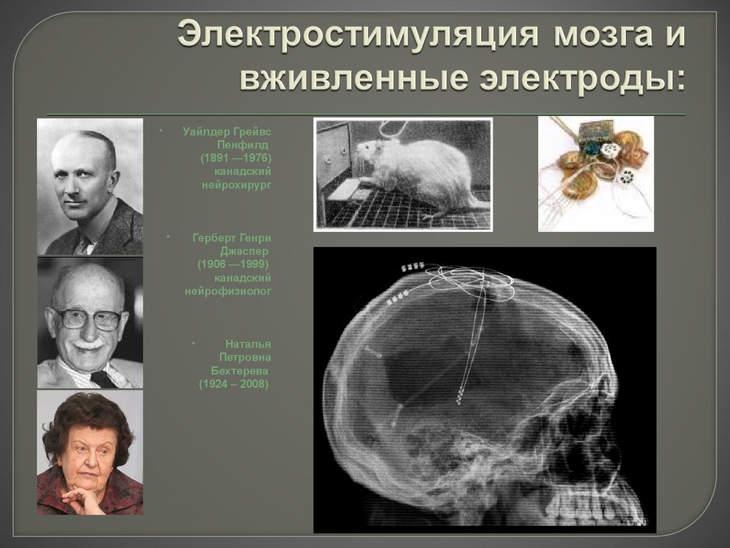 Стимуляция мозга. Пенфилд Уайлдер Пенфилд. Уайлдер Грейвс Пе́нфилд. Вживление электродов в мозг. Имплантировали электроды в мозг.