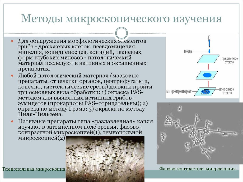 Обнаружены споры и мицелий. Мицелий гриба микроскопия. Микроскопические грибы микроскопия. Методы изучения грибов в световом микроскопе. Методы изучения микроскопических грибов и актиномицетов.