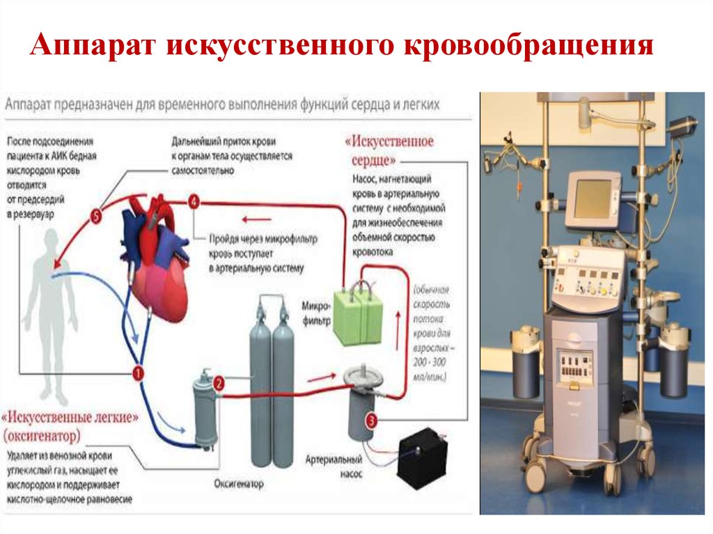 Как работает искусственный. АИК аппарат искусственного кровообращения. Аппарат искусственного кровообращения (АИК) строение. АИК аппарат искусственного кровообращения схема. Структурная схема аппарата искусственного кровообращения.