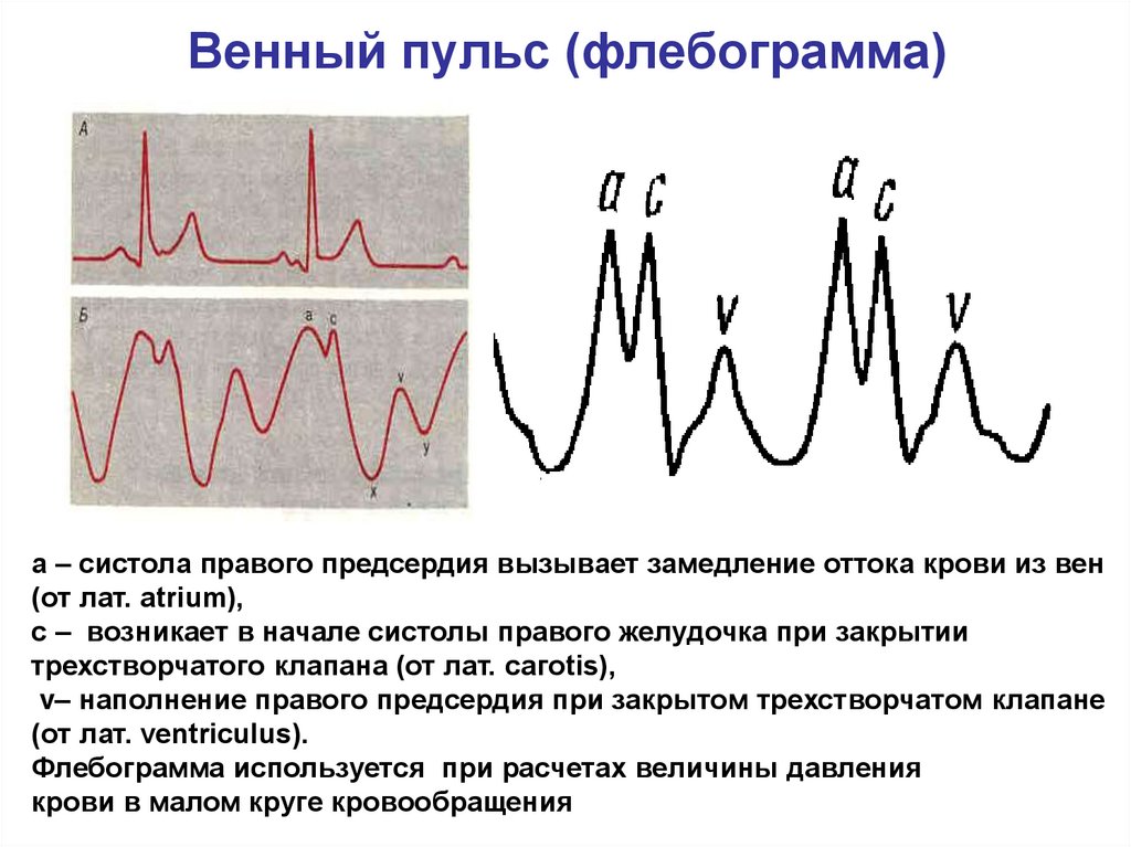 Положительный венный. Венный пульс флебограмма. Флебограмма физиология. Сфигмография и флебография. 11. Венный пульс (флебограмма). Происхождение зубцов флебограммы..