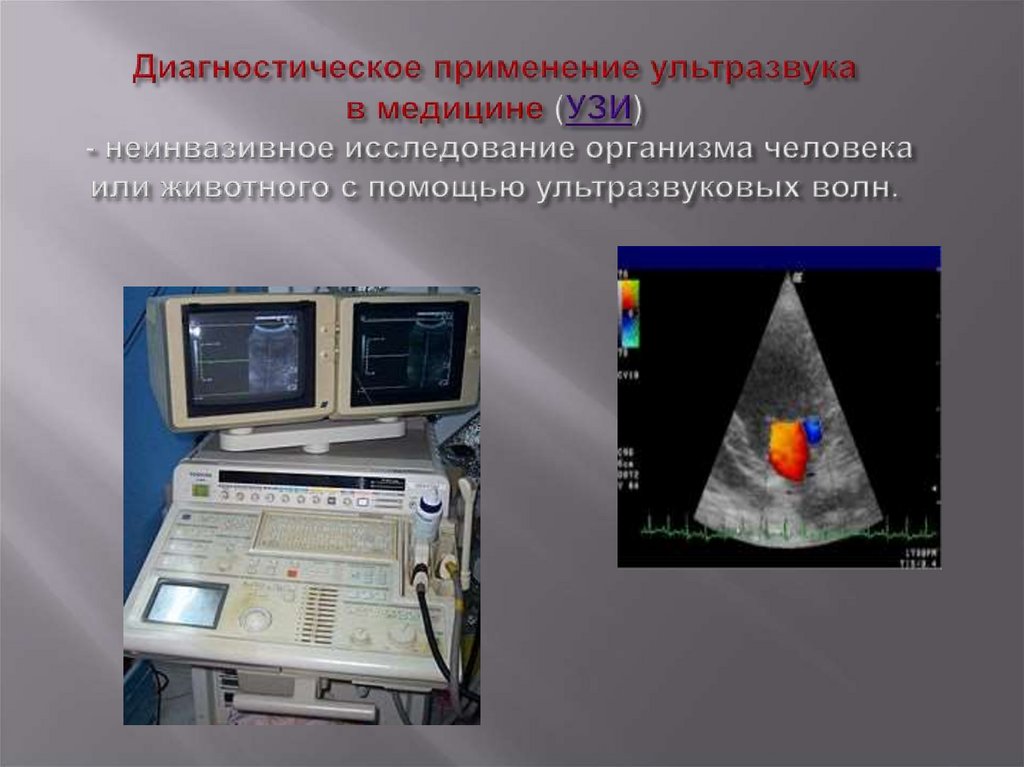 Ультразвук медицина презентация