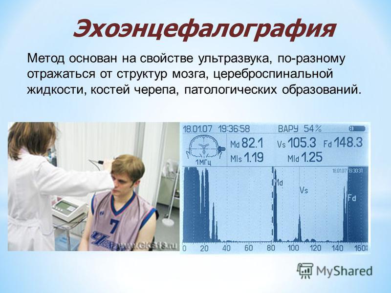 Эс что делает. Эхоэнцефалография эмиссионный метод. Эхоэнцефалография методика проведения. Эхоэнцефалоскопия (м-Эхо). Эхоэнцефалография заключение норма.