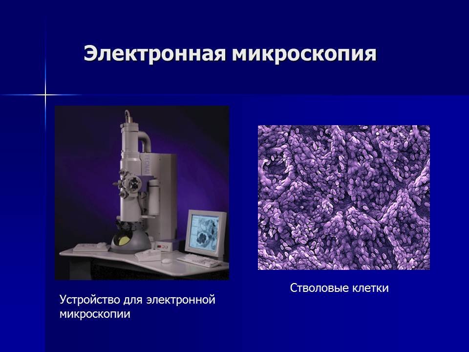 Электронная микроскопия без криообработки. Электронная микроскопия. Методы электронной микроскопии. Виды электронной микроскопии. Электронный микроскоп биология.