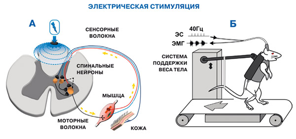 Стимуляция это. Электростимулятор спинного мозга. Электрический стимулятор спинного мозга. Эпидуральной электростимуляции спинного мозга. Чрескожная электростимуляция спинного мозга.