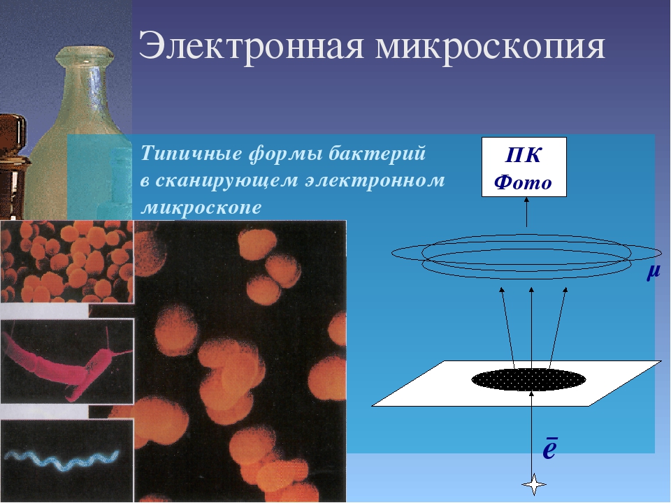 Применение метода микроскопии. Виды электронной микроскопии. Бактерии электронная микроскопия. Микроскопия микроорганизмов. Сканирующая микроскопия бактерии.